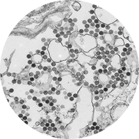 Heartland virus disease blood smear