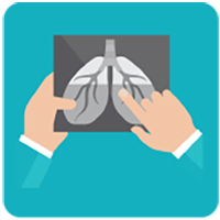 Hands holding an xray