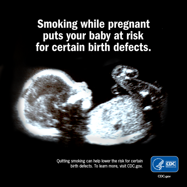 Smoking during pregnancy increases the risk for birth defects. Smoking during pregnancy increases the risk for birth defects.