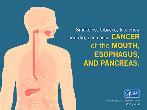 Smokeless Health Effects Smokeless tobacco, like chew and dip, can cause cancer of the mouth, esophagus, and pancreas.