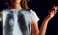 Person holding cigarette and x-ray image of lungs