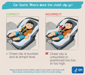 Car seats where does the chest clip go Car seats: where does the chest clip go? Correct: chest clip is buckled and at armpit level. Incorrect: chest clip is unbuckled or positioned too low or too high. Always properly buckle children aged 12 and under in the back seat! Never place a rear-facing car seat in front of an active airbag. HHS CDC