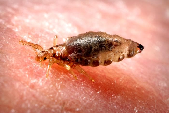 body-lice Xenopsylla cheopis, the Oriental rat flea