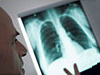 resources-vsi.gif prevent pneumonia