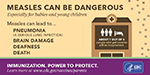 Measles: More than just a little rash infographic.