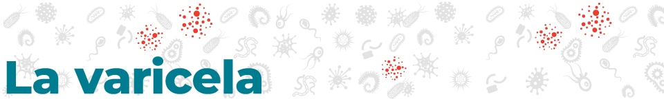 disease_banners_chickenbox_960_144-sp La varicela
