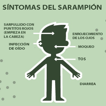 Síntomas del sarampión Síntomas del sarampión