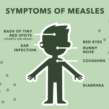 symptoms-measles.jpg Symptoms of measles.