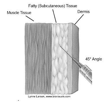vac-admin-fig-01.jpg Figure 1: image of needle entering Fatty (subcutaneous) tissue, at 45 degree angle, through the dermis, stopping before the muscle tissue. by Lynne Larson. www.biovisuals.com