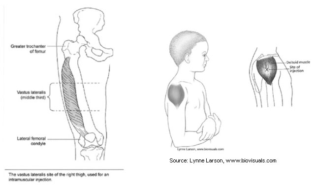 vac-admin-fig-05a.jpg images of baby and vastus laterlis muscle and site of the upper and right thigh used for intramuscular injections. image of youth and deltoid muscle site of injection. Lynne Larson: www.biovisuals.com