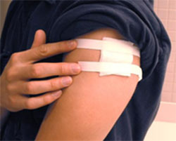 Image of a vaccination site covered.