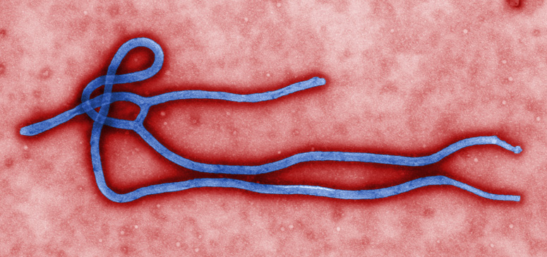 About Ebola Colorized transmission electron micrograph (TEM) of ebola virus virion.