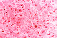 liver tissue specimen
