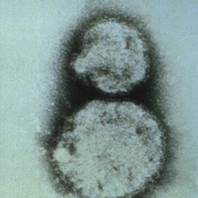 Bunyaviridae The Arenaviridae are a family of viruses whose members are generally associated with rodent-transmitted diseases in humans.