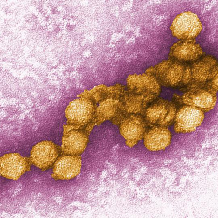 Flaviviridae Digitally-colorized transmission electron micrograph of the West Nile virus, in the flavivirus family.