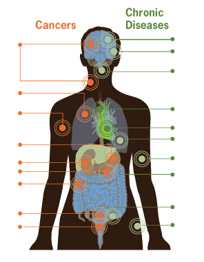 Graphic: This image is illustrates how smoking can damage every part of the body. The image show an outline of a human body. Internal organs are visible, and circles mark the locations where smoking causes damage. On the left side of the body, the following locations and organs are marked with circles to identify cancers caused by smoking: Head or neck, lung, stomach, kidney, pancreas, colon, cervix, and bladder. On the right side of the body, the following locations and organs are marked with circles to identify chronic diseases caused by smoking: stroke, blindness, gum infection, aortic rupture, heart disease, pneumonia, hardening of the arteries, chronic lung disease/asthma, reduced fertility, and hip fracture. Click to view larger image. Graphic: This image is illustrates how smoking can damage every part of the body. The image show an outline of a human body. Internal organs are visible, and circles mark the locations where smoking causes damage. On the left side of the body, the following locations and organs are marked with circles to identify cancers caused by smoking: Head or neck, lung, stomach, kidney, pancreas, colon, cervix, and bladder. On the right side of the body, the following locations and organs are marked with circles to identify chronic diseases caused by smoking: stroke, blindness, gum infection, aortic rupture, heart disease, pneumonia, hardening of the arteries, chronic lung disease/asthma, reduced fertility, and hip fracture. Click to view larger image.