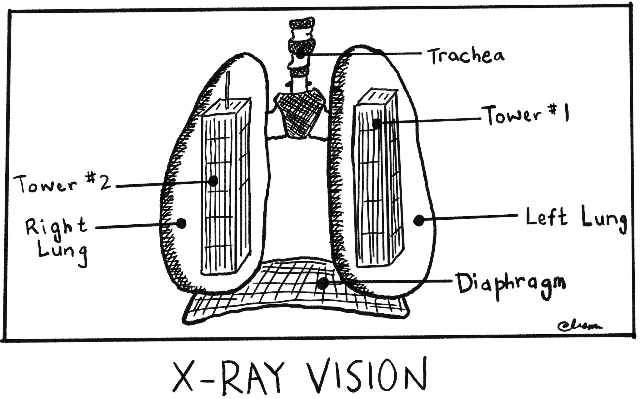 Cartoon reproduction of lungs created and provided by Ali Shapiro,
former Stuyvesant High School Student.