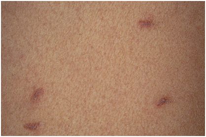 Skin with tiny, pimple-like red spots.