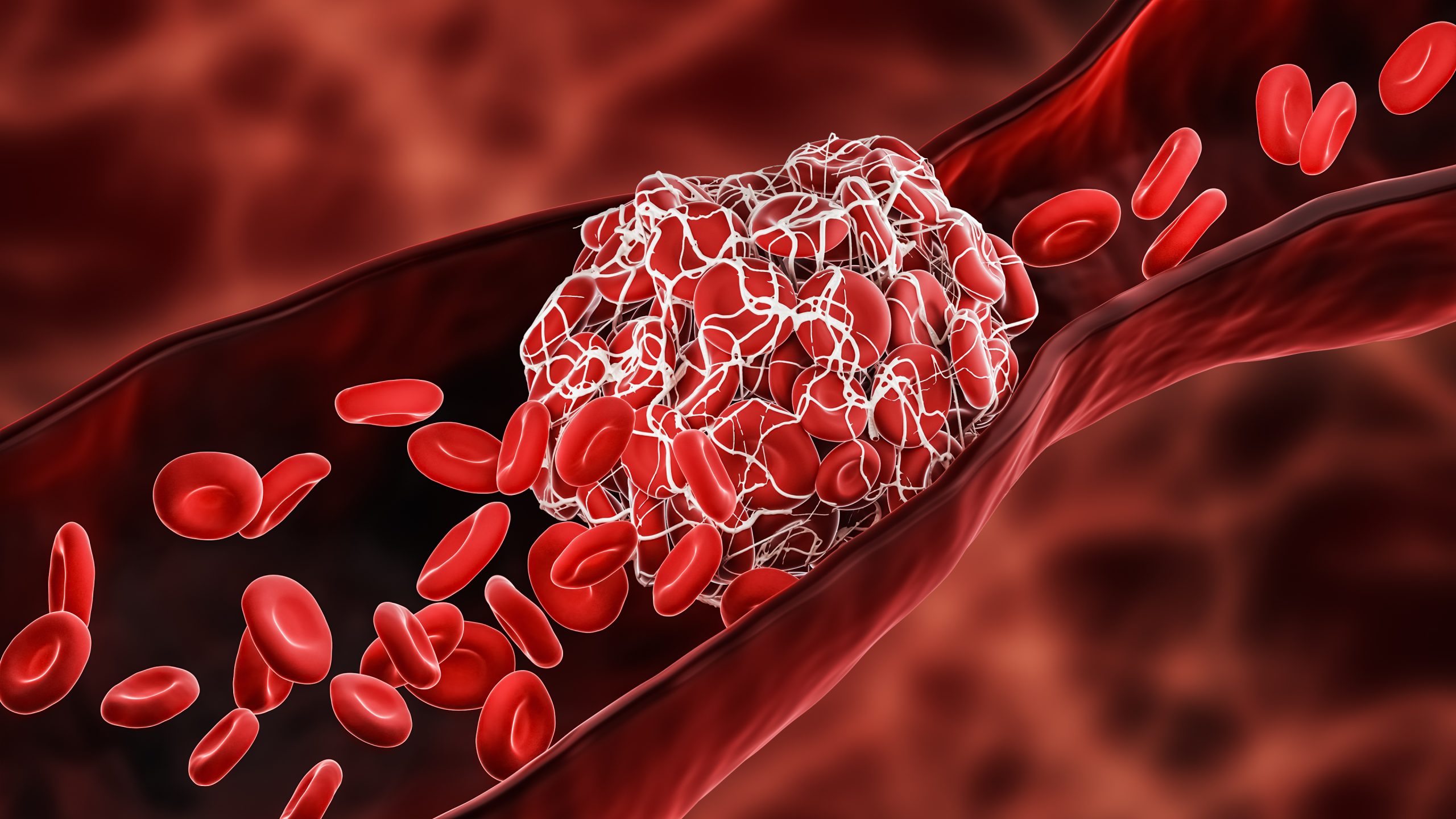 Artistic illustration of a blood clot.