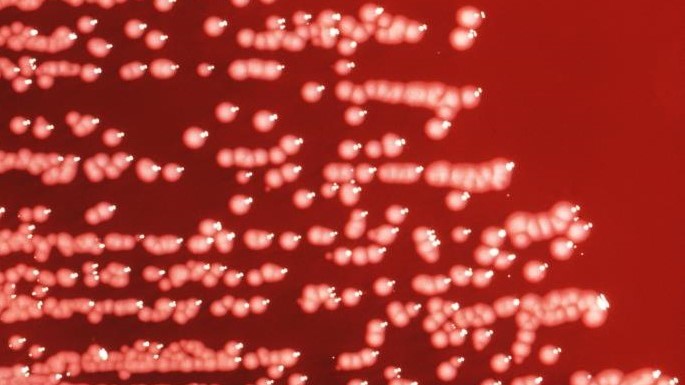 Colonies of Yersinia enterocolitica bacteria growing on an agar plate.