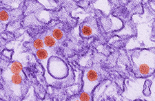 zika-tem.jpg digitally-colorized transmission electron micrograph (TEM) of Zika virus